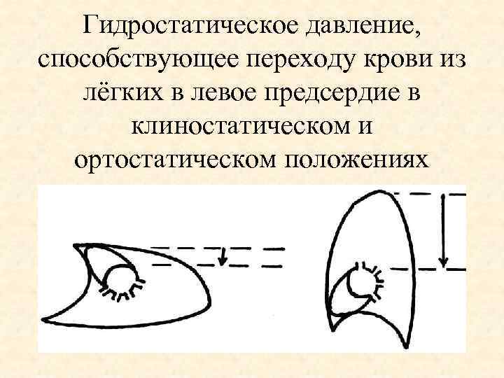 Гидростатическое давление, способствующее переходу крови из лёгких в левое предсердие в клиностатическом и ортостатическом