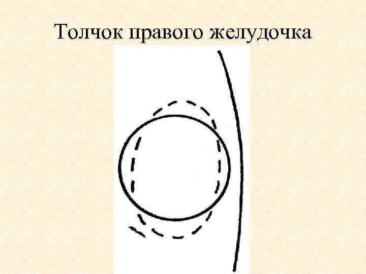 Толчок правого желудочка 