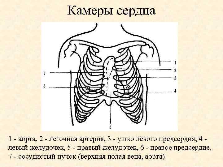 Камеры сердца 1 - аорта, 2 - легочная артерия, 3 - ушко левого предсердия,