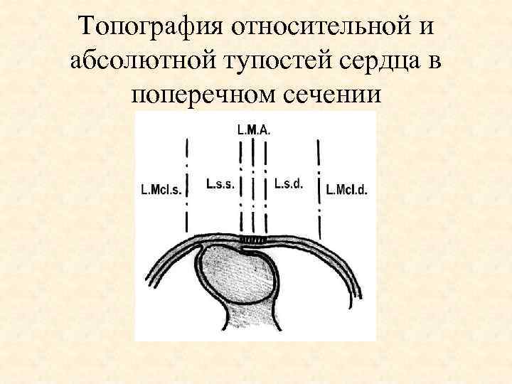 Топография относительной и абсолютной тупостей сердца в поперечном сечении 