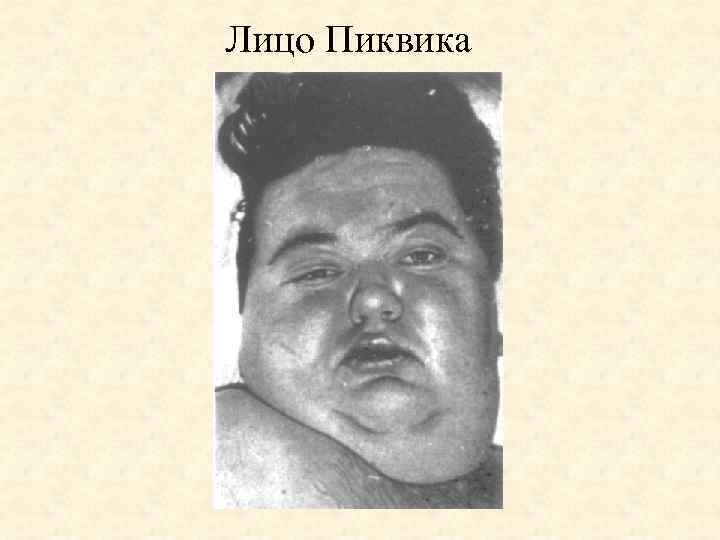 Лицо Пиквика 