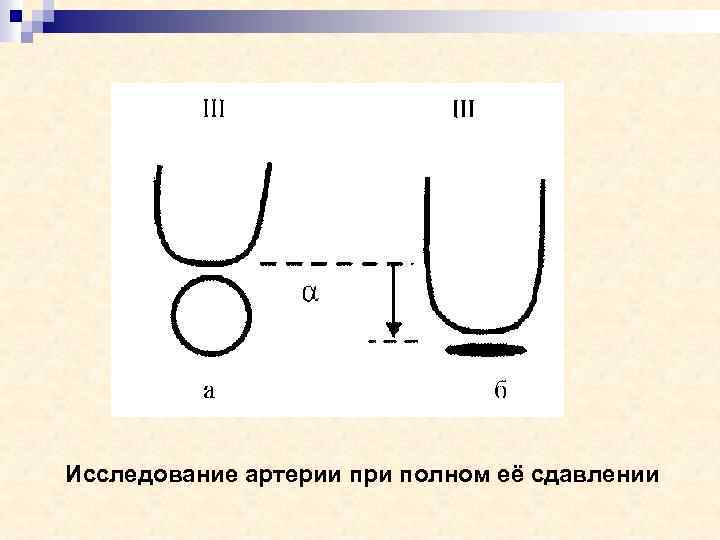 Исследование артерии при полном её сдавлении 