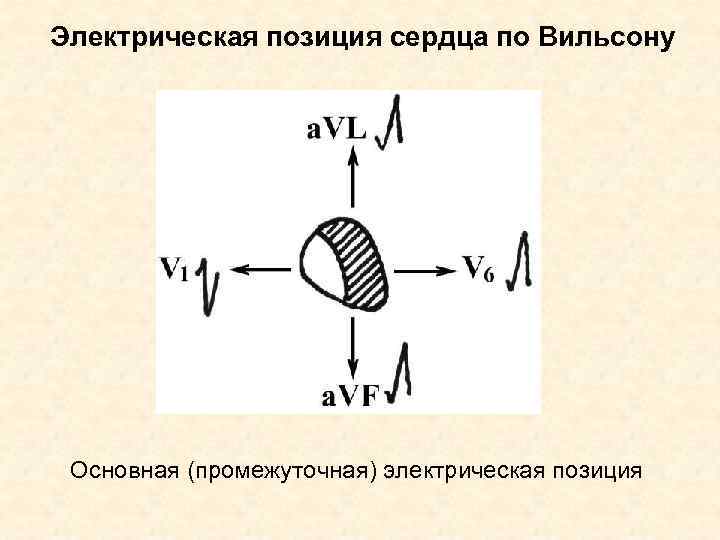 Электрическая позиция сердца по Вильсону Основная (промежуточная) электрическая позиция 