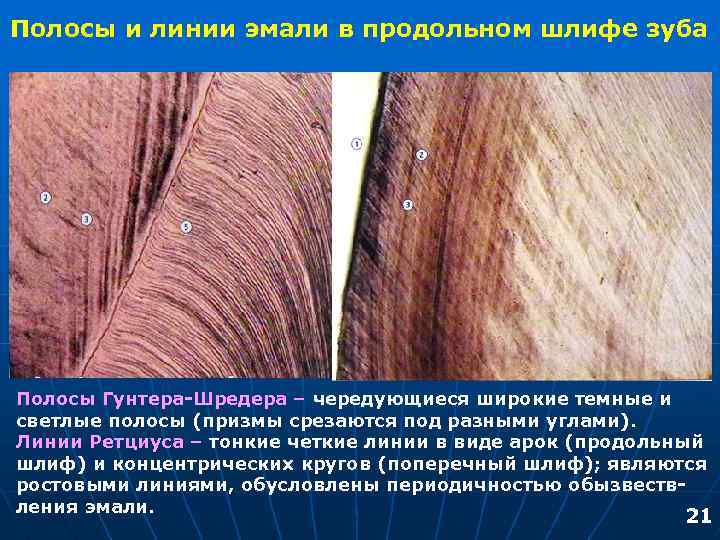 Полосы и линии эмали в продольном шлифе зуба Полосы Гунтера-Шредера – чередующиеся широкие темные