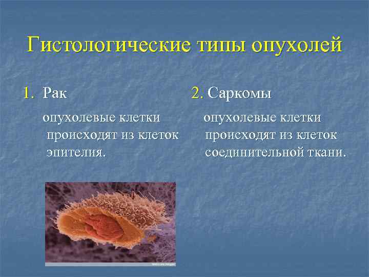 Гистологические типы опухолей 1. Рак опухолевые клетки происходят из клеток эпителия. 2. Саркомы опухолевые