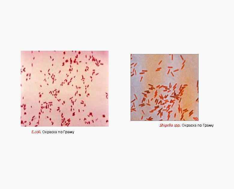 Shigella spp. Окраска по Граму E. coli. Окраска по Граму 