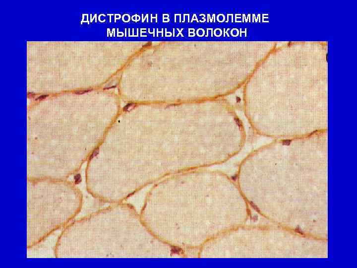 ДИСТРОФИН В ПЛАЗМОЛЕММЕ МЫШЕЧНЫХ ВОЛОКОН 