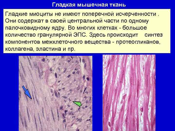 Гладкая мышечная ткань рисунок