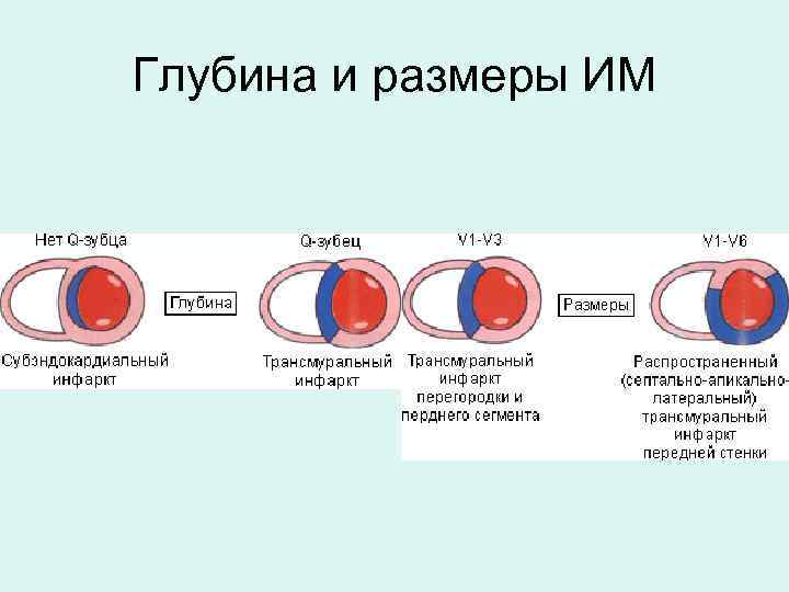 Глубина и размеры ИМ 