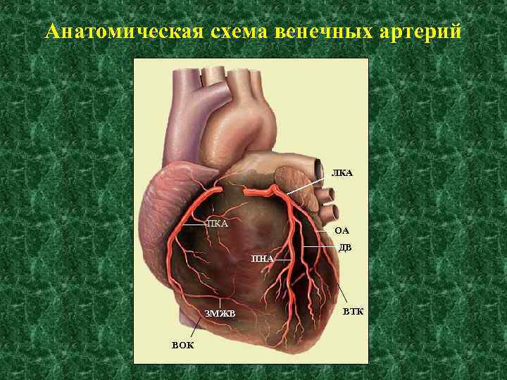 Анатомическая схема венечных артерий ЛКА ПКА ОА ДВ ПНА ЗМЖВ ВОК ВТК 