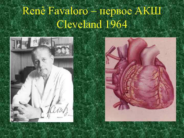 Renè Favaloro – первое АКШ Cleveland 1964 