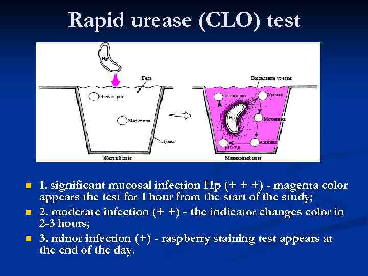Rapid urease (CLO) test n n n 1. significant mucosal infection Hp (+ +