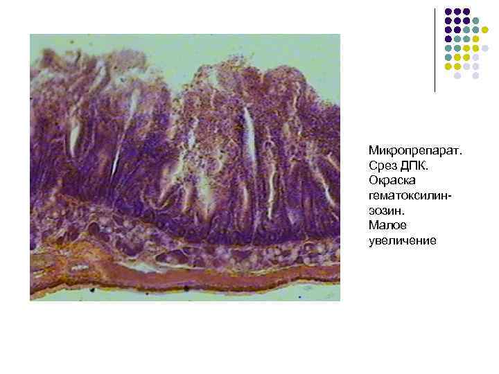 Микропрепарат. Срез ДПК. Окраска гематоксилинэозин. Малое увеличение 