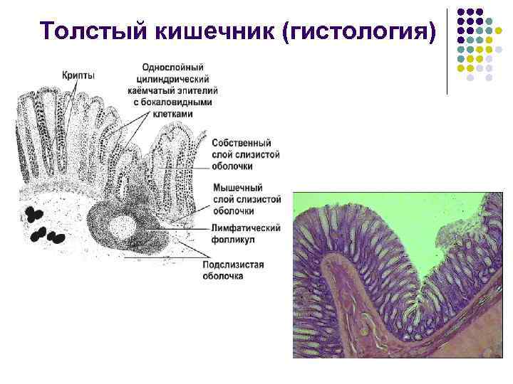 Толстая кишка гистология препарат