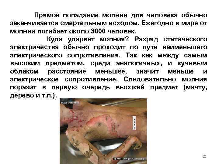 Прямое попадание молнии для человека обычно заканчивается смертельным исходом. Ежегодно в мире от молнии