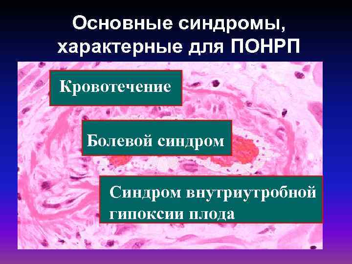 Основные синдромы, характерные для ПОНРП Кровотечение Болевой синдром Синдром внутриутробной гипоксии плода 