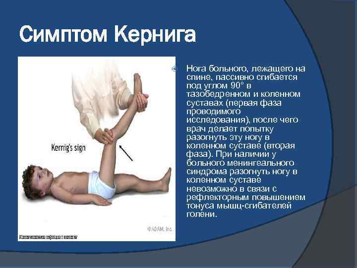 Симптом Кернига Нога больного, лежащего на спине, пассивно сгибается под углом 90° в тазобедренном