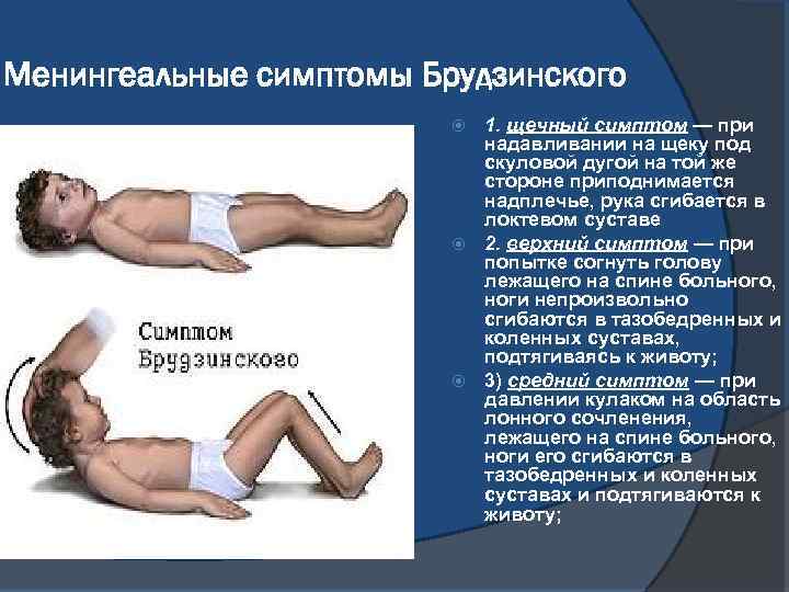 Менингеальные симптомы Брудзинского 1. щечный симптом — при надавливании на щеку под скуловой дугой