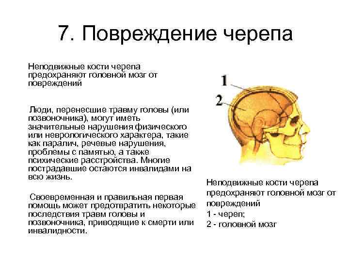 Травмы черепа и головного мозга