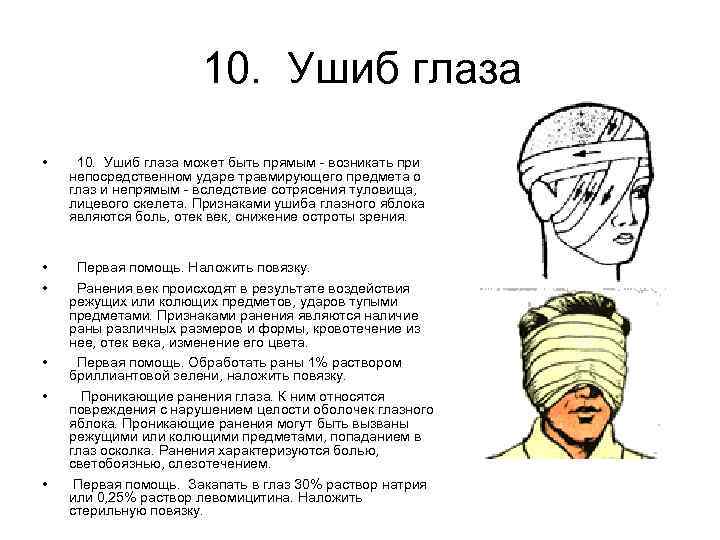 10. Ушиб глаза • 10. Ушиб глаза может быть прямым - возникать при непосредственном