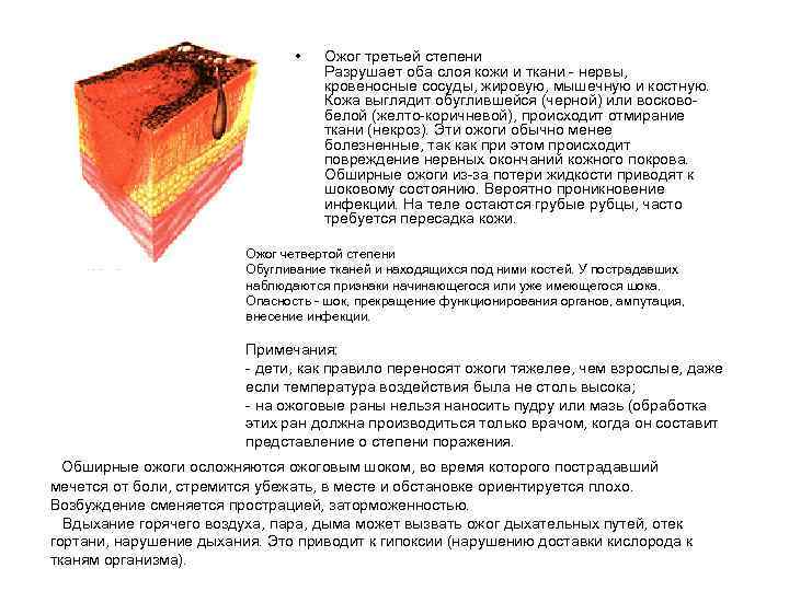  • Ожог третьей степени Разрушает оба слоя кожи и ткани - нервы, кровеносные