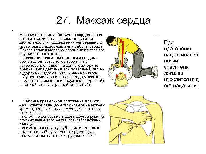 27. Массаж сердца • • механическое воздействие на сердце после его остановки с целью