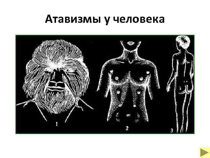 Атавизмы у человека 