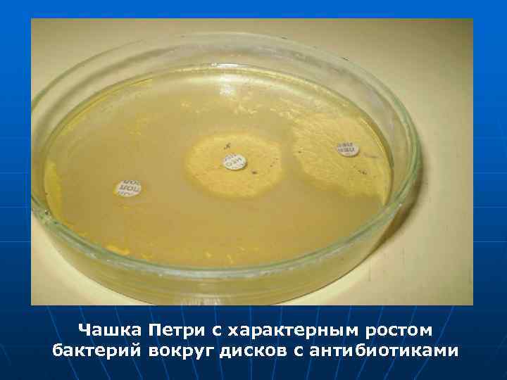 Чашка Петри с характерным ростом бактерий вокруг дисков с антибиотиками 