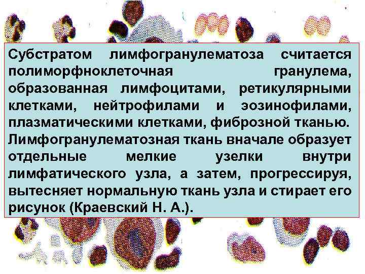 Субстратом лимфогранулематоза считается полиморфноклеточная гранулема, образованная лимфоцитами, ретикулярными клетками, нейтрофилами и эозинофилами, плазматическими клетками,