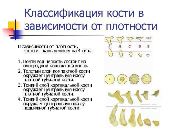 Результаты кости. Типы кости по плотности. Типы костной ткани челюстей классификация. Типы костной ткани d1 d2 d3 d4. Классификация костей стоматология.