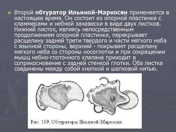 ► Второй обтуратор Ильиной-Маркосян применяется в настоящее время. Он состоит из опорной пластинки с