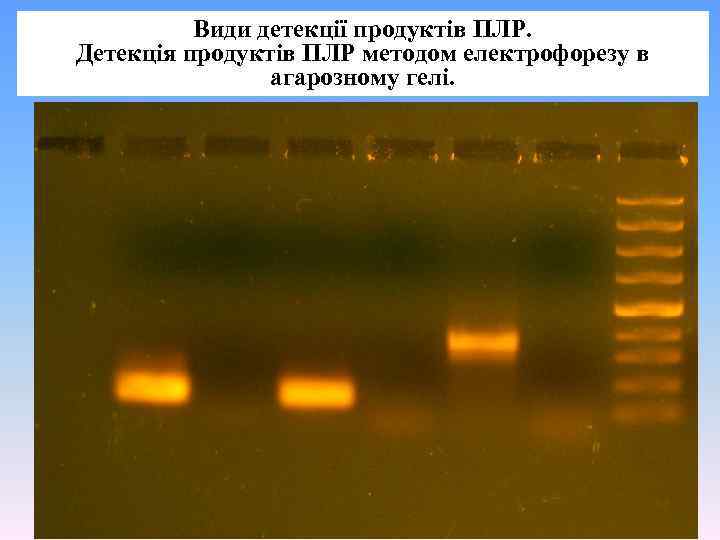 Види детекції продуктів ПЛР. Детекція продуктів ПЛР методом електрофорезу в агарозному гелі. 