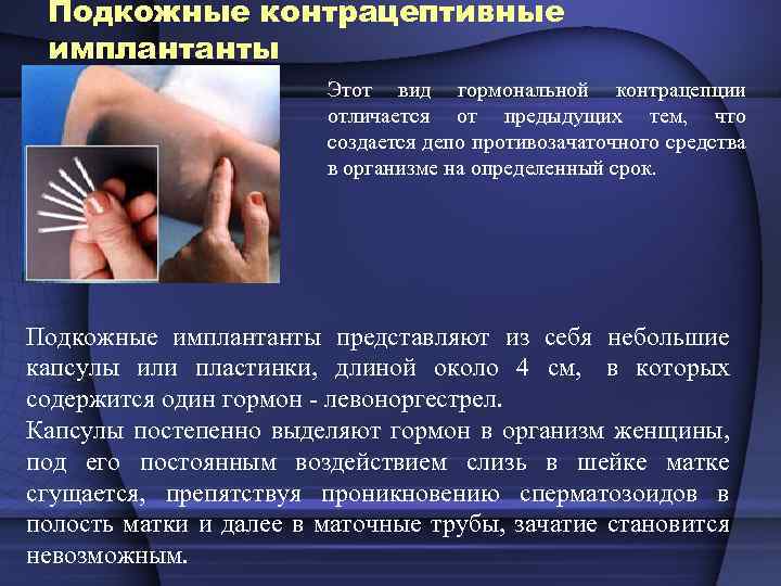 Подкожные контрацептивные имплантанты Этот вид гормональной контрацепции отличается от предыдущих тем, что создается депо