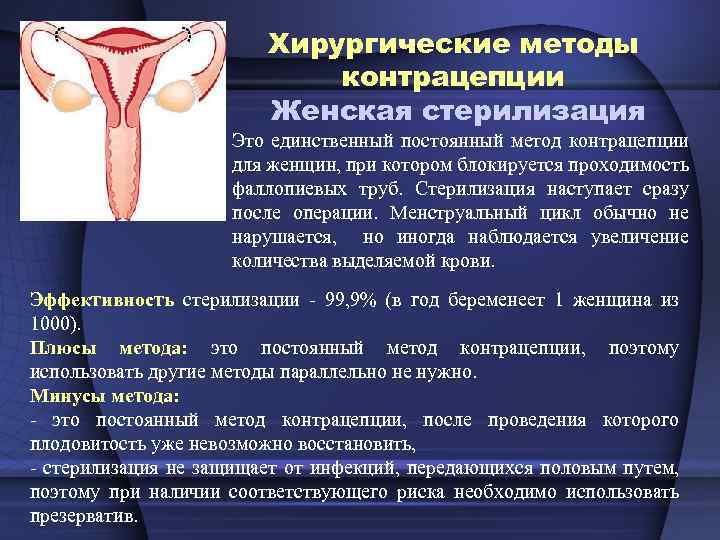 Хирургические методы контрацепции Женская стерилизация Это единственный постоянный метод контрацепции для женщин, при котором