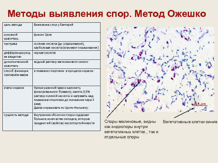 Методы выявления спор. Метод Ожешко цель метода Выявление спор у бактерий основной краситель фуксин