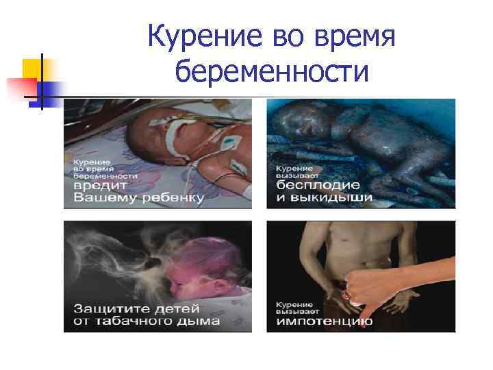 Курение во время беременности 