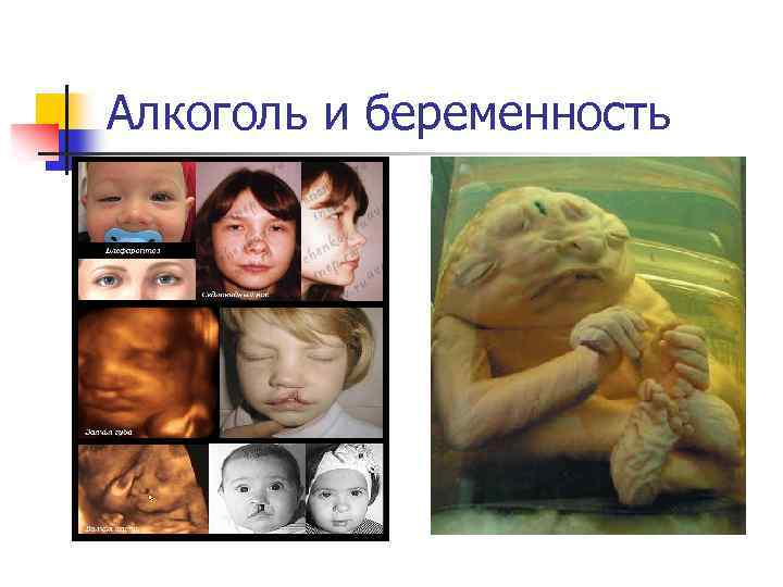 Алкоголь и беременность 