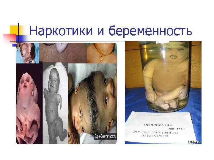 Наркотики и беременность 