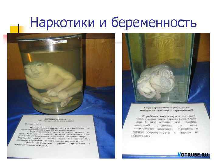 Наркотики и беременность 