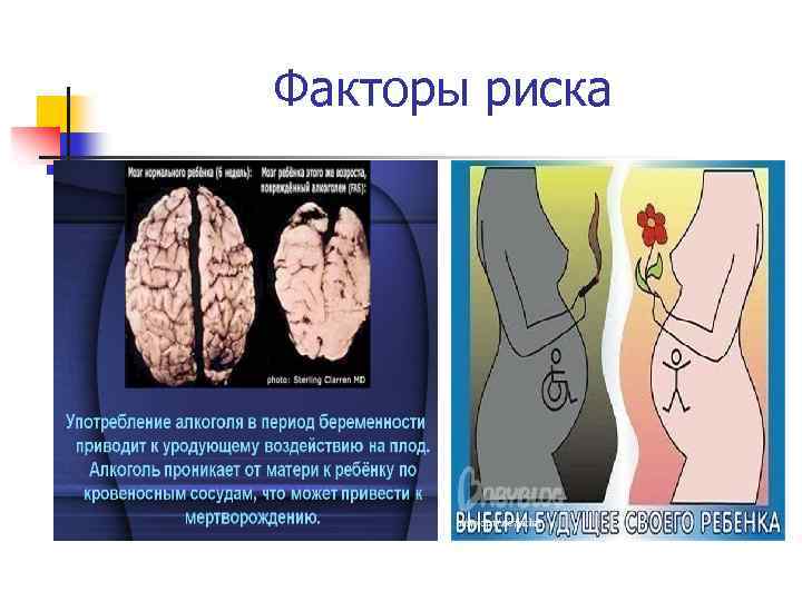 Факторы риска 