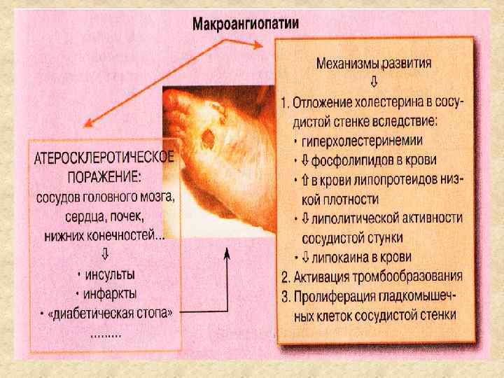 Нарушение углеводного обмена картинки