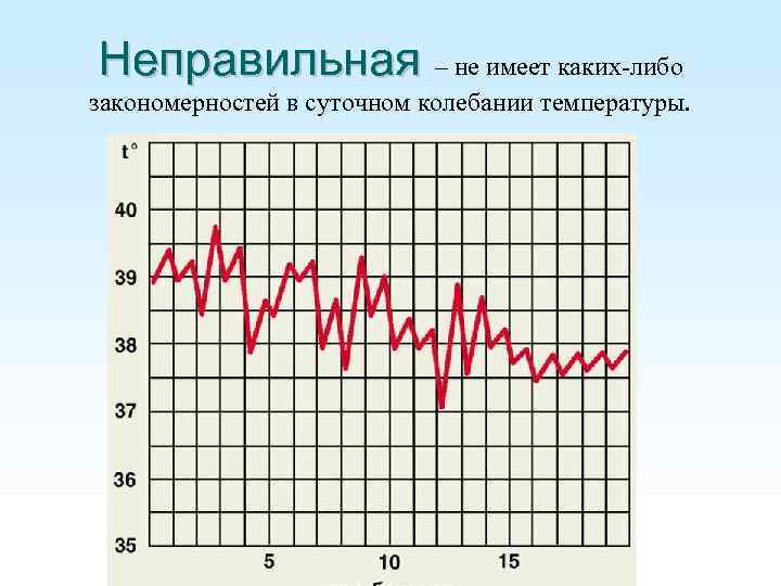Неправильная – не имеет каких-либо закономерностей в суточном колебании температуры. 