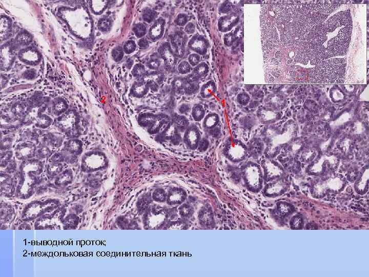 2 1 -выводной проток; 2 -междольковая соединительная ткань 1 