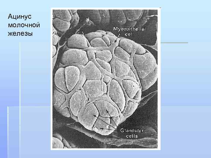 Ацинус молочной железы 