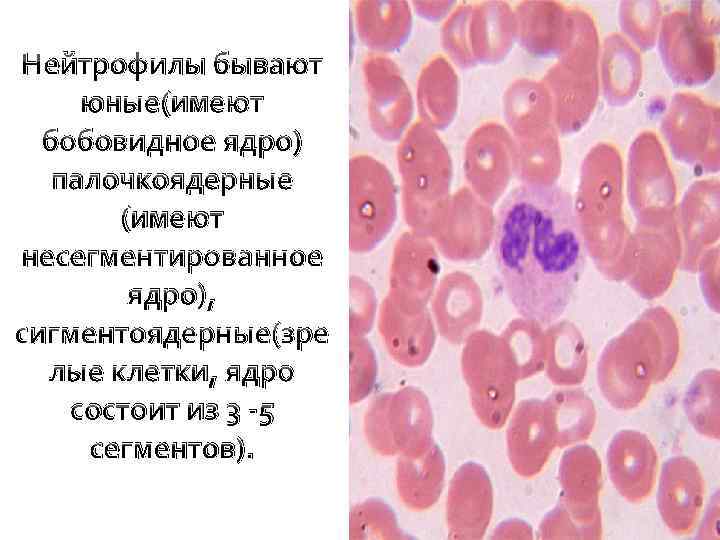 Нейтрофилы бывают юные(имеют бобовидное ядро) палочкоядерные (имеют несегментированное ядро), сигментоядерные(зре лые клетки, ядро состоит