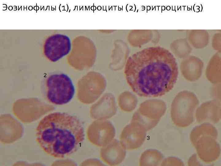 Эозинофилы (1), лимфоциты (2), эритроциты(3) 2 1 3 1 