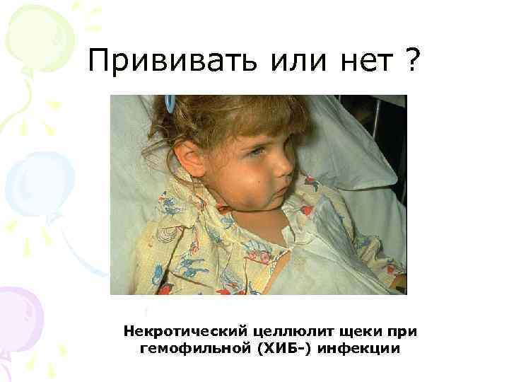 Прививать или нет ? Некротический целлюлит щеки при гемофильной (ХИБ-) инфекции 