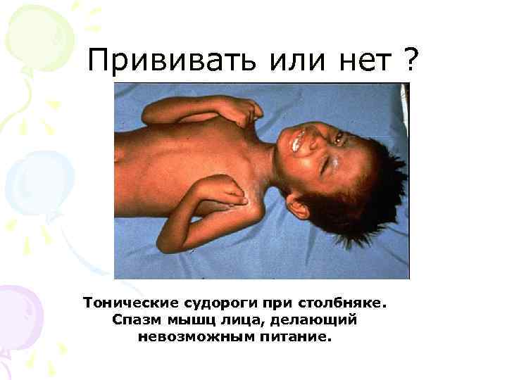 Прививать или нет ? Тонические судороги при столбняке. Спазм мышц лица, делающий невозможным питание.