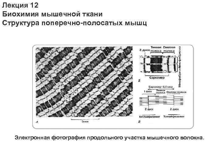 На рисунке изображена поперечная. Схема мышечного волокна биохимия. Структурные компоненты мышечного волокна биохимия. Биохимия мышечной ткани. Строение мышечной ткани биохимия.