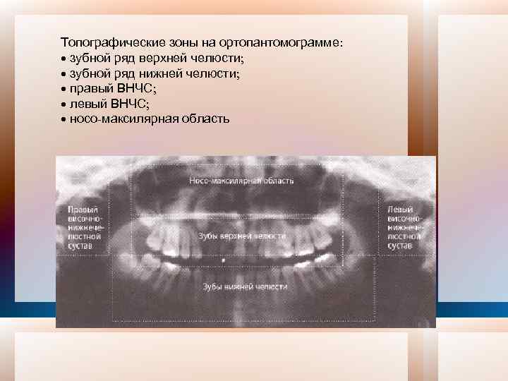 Схема описания оптг